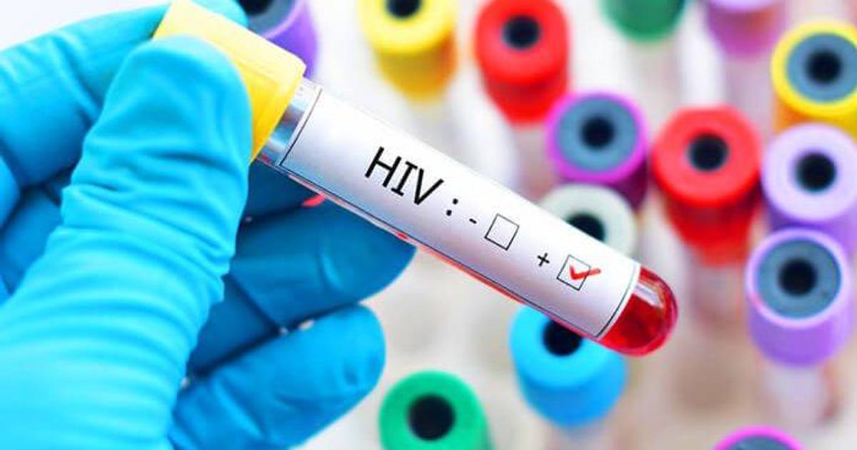 Featured image for “Prof. Victor Wutor urges Ghana to invest heavily in long-acting HIV prevention drugs”